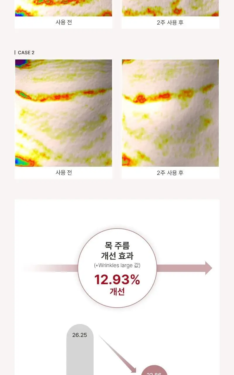 [탄력/목주름케어] 미차이 바쿠치올 수플레 바디크림 200G 상세페이지 17